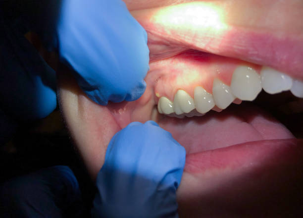 Best Pediatric Emergency Dentist in Cactus, TX